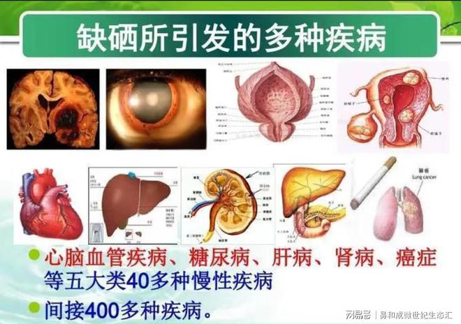 j9九游会什么样的人群最容易缺硒？(图3)